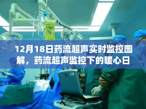 藥流超聲實時監(jiān)控下的溫馨時光，暖心日常與友共度時刻