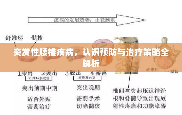 突發(fā)性腰椎疾病，認識預防與治療策略全解析