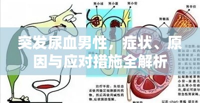 突發(fā)尿血男性，癥狀、原因與應(yīng)對(duì)措施全解析