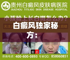 白癜風(fēng)獨家秘方： 