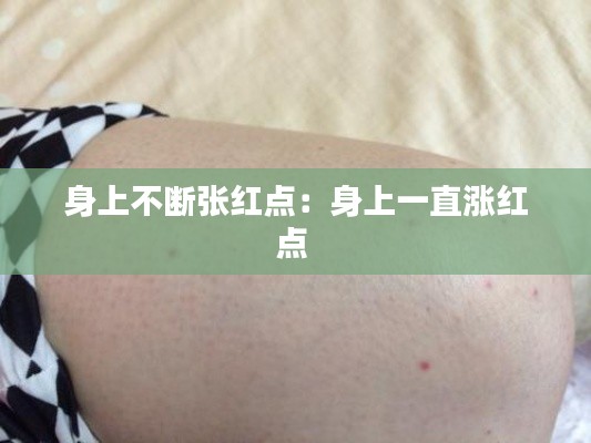 身上不斷張紅點(diǎn)：身上一直漲紅點(diǎn) 
