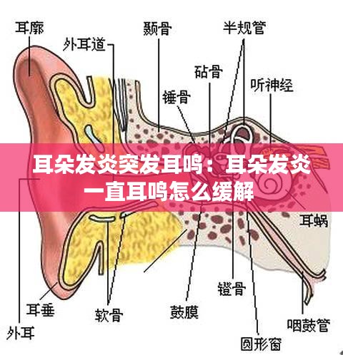 耳朵發(fā)炎突發(fā)耳鳴：耳朵發(fā)炎一直耳鳴怎么緩解 