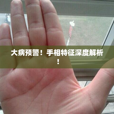大病預(yù)警！手相特征深度解析！