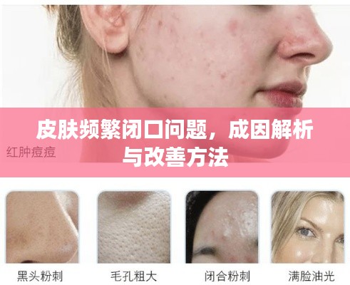 皮膚頻繁閉口問題，成因解析與改善方法