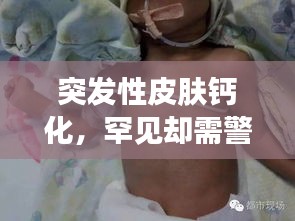突發(fā)性皮膚鈣化，罕見卻需警惕的皮膚病