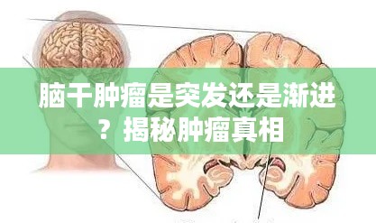 腦干腫瘤是突發(fā)還是漸進？揭秘腫瘤真相