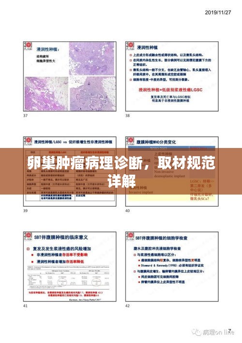 卵巢腫瘤病理診斷，取材規(guī)范詳解